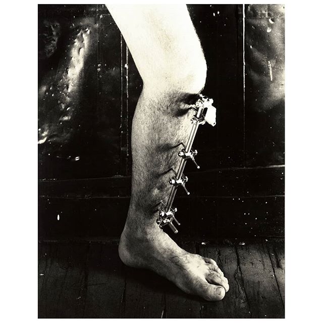 © OBJECT: LEG
WORKS ON FILM- PELICULA
4X5 large format film,
Kodak Tmax 400
© @spiro_photographer
Spiro Polichronopoulos

#leg #blackandwhite #filmphotography #photocollection #stylized #break #ouch #largeformatphotography #film

WARNING: This image is copyrighted and may not be used without permission and credit. When authorized, this image may only be used as a SHARED POST from my professional page. All other options will be immediately reported and removed.
No edited version or any other use is permitted unless authorized in writing.
Please inbox me for details